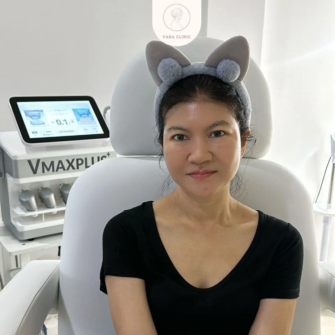คุณนันท์นภัส ลูกค้าเลเซอร์ความงาม Vada Clinic ระยอง
